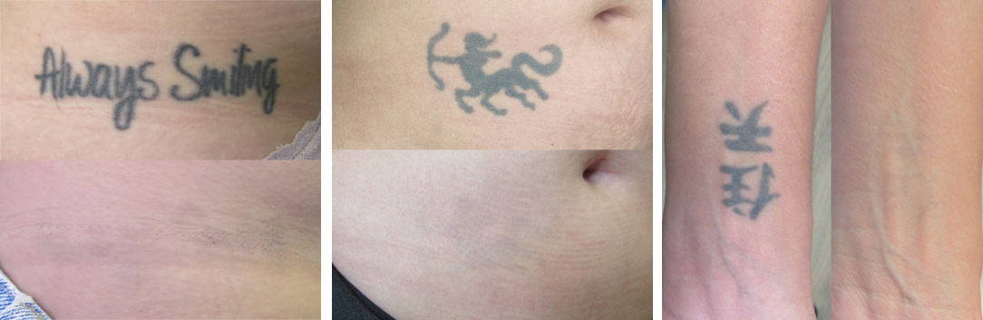 3tat2.png