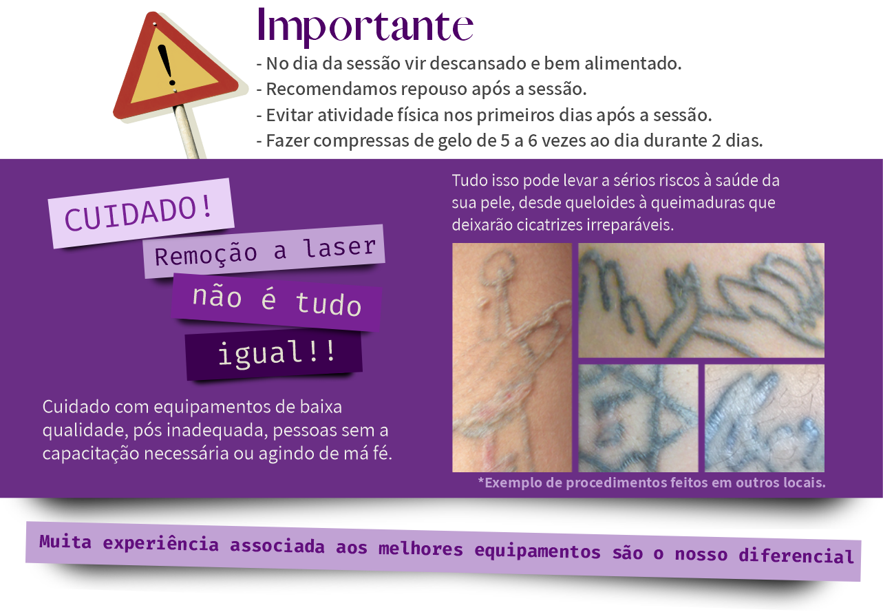 importante.png