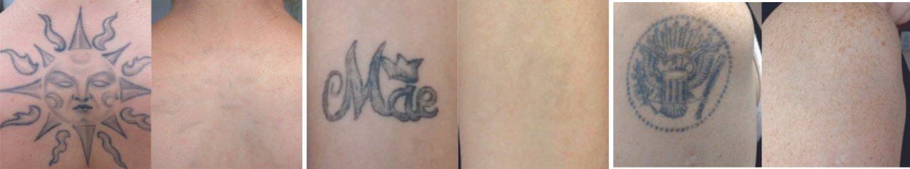 3tat.png